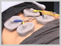 メタボリック対策にはテクトロン